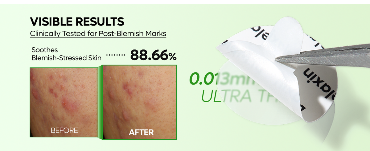 S-ZINC ZERO FIT Ultra Thin Blemish Spot Patch