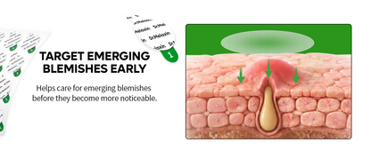 S-ZINC ZERO FIT Ultra Thin Blemish Spot Patch