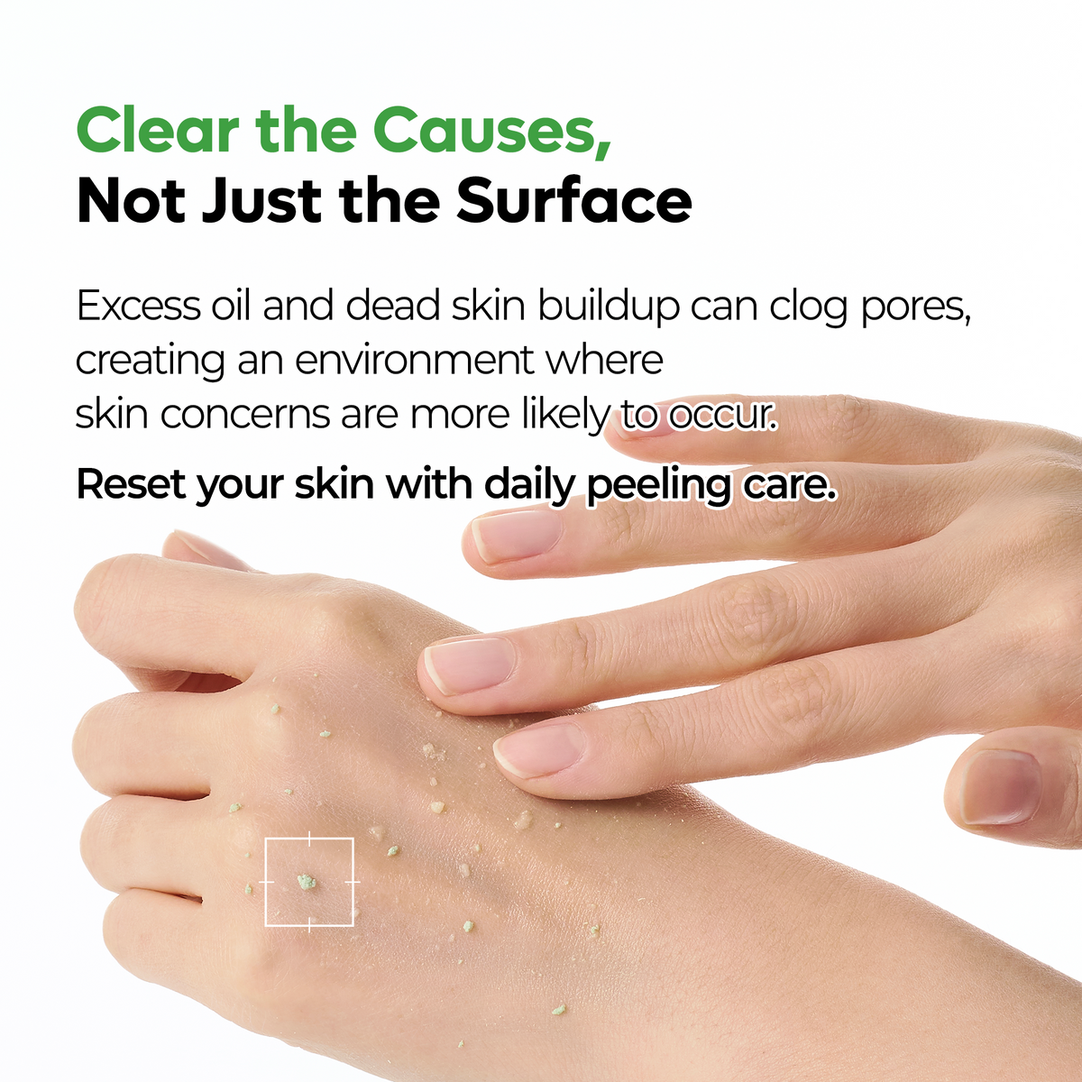 PEEL SHOT Exfoliating S-ZINC Blemish Serum