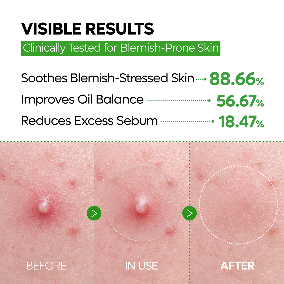Zero Fit Blemish & Dark Spot Patch Duo